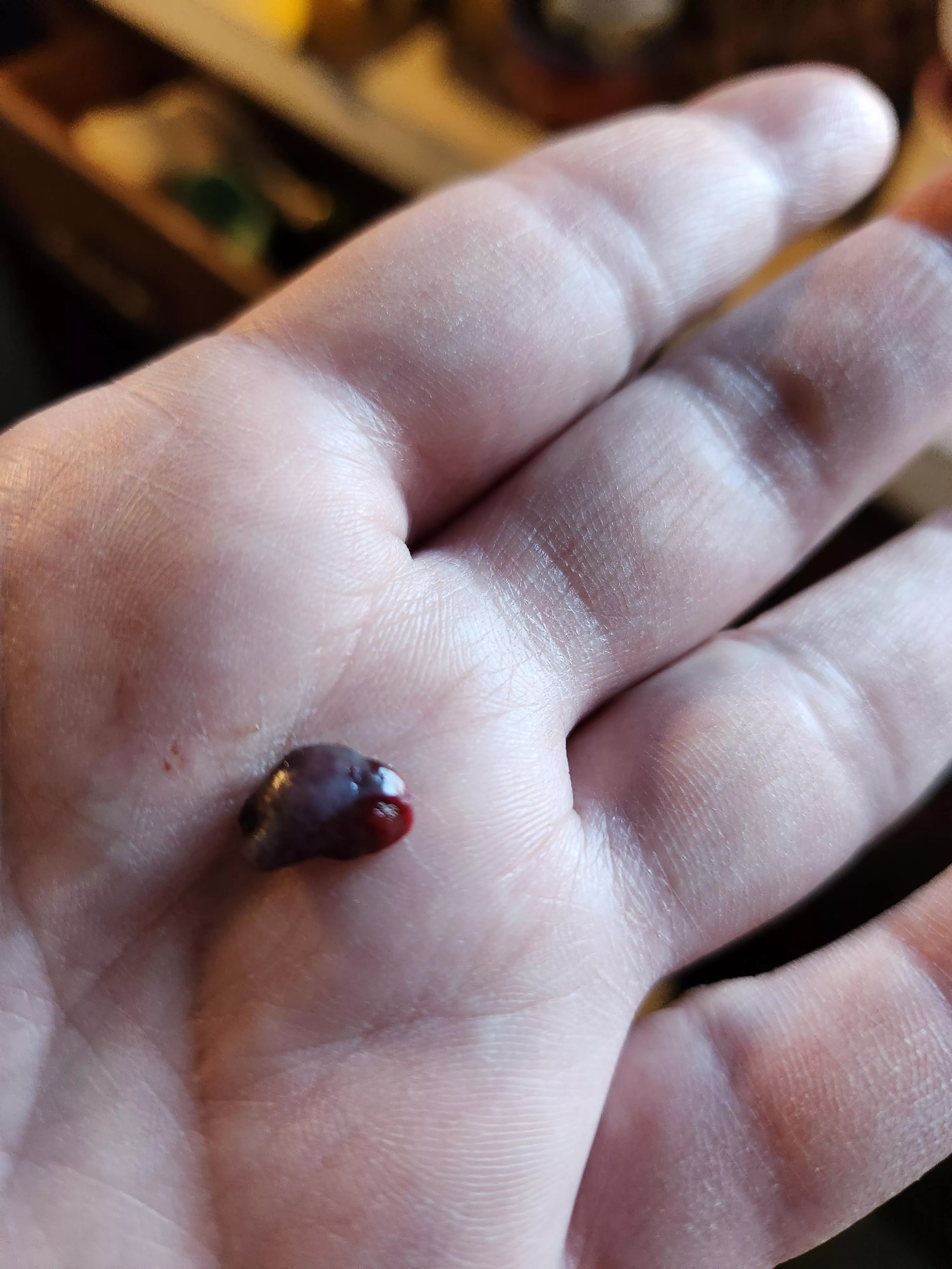 Had this growth in my nose for 2 weeks, finally fell out today