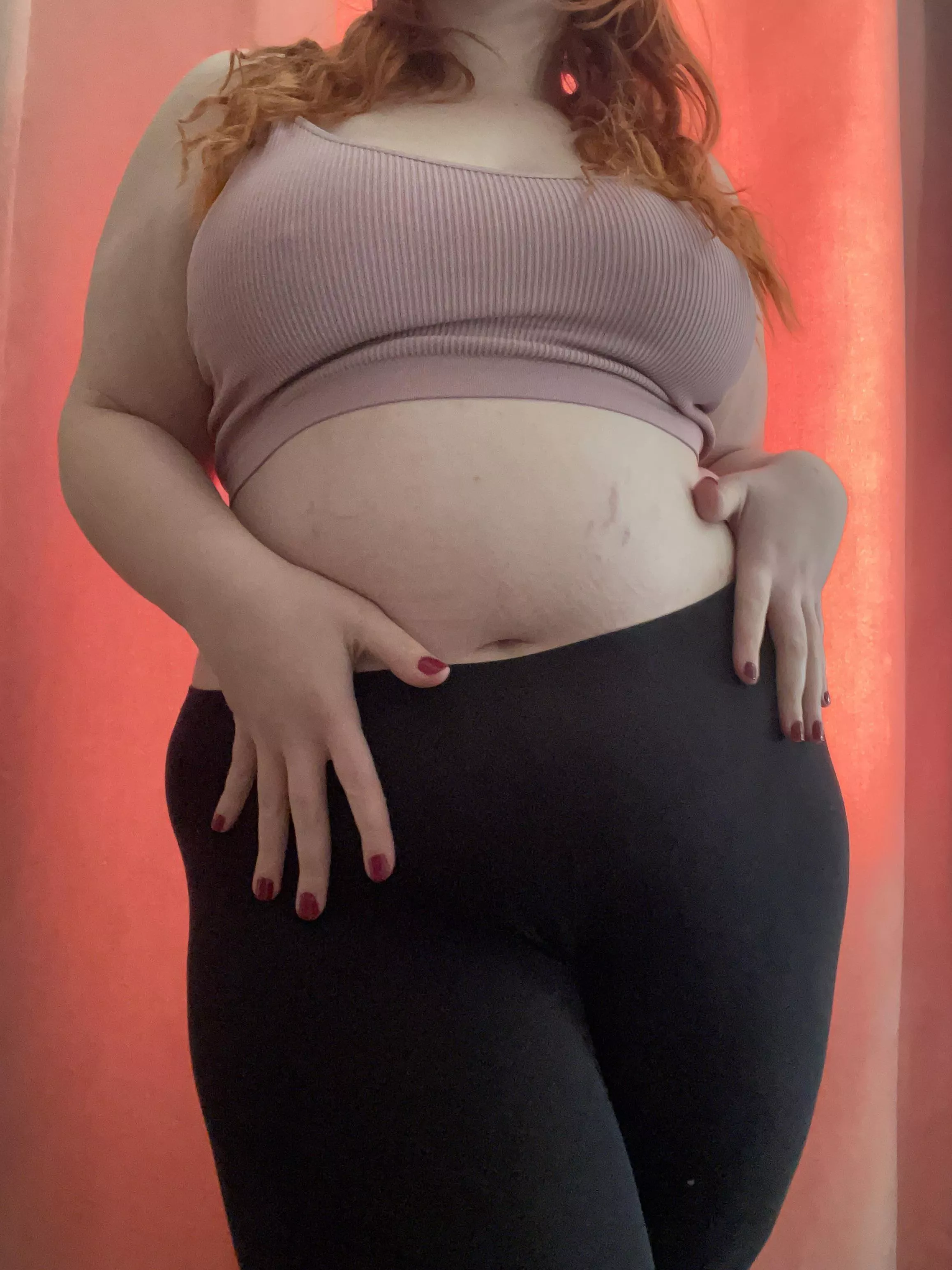 My stretch marks look so cute