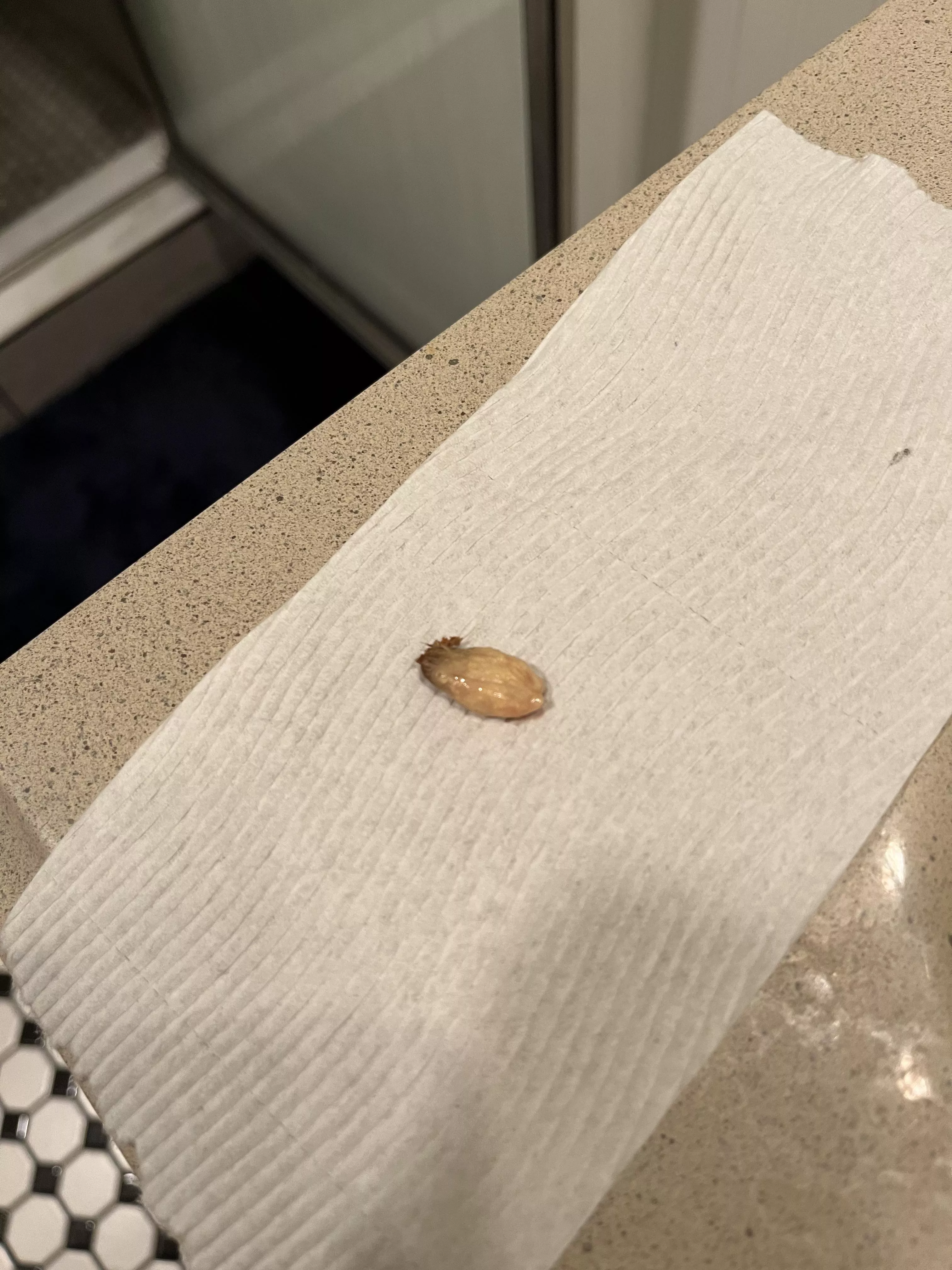 Wife pulled this out of my bellybutton. Size of a large kidney bean. Thought she was gonna leave me after this…