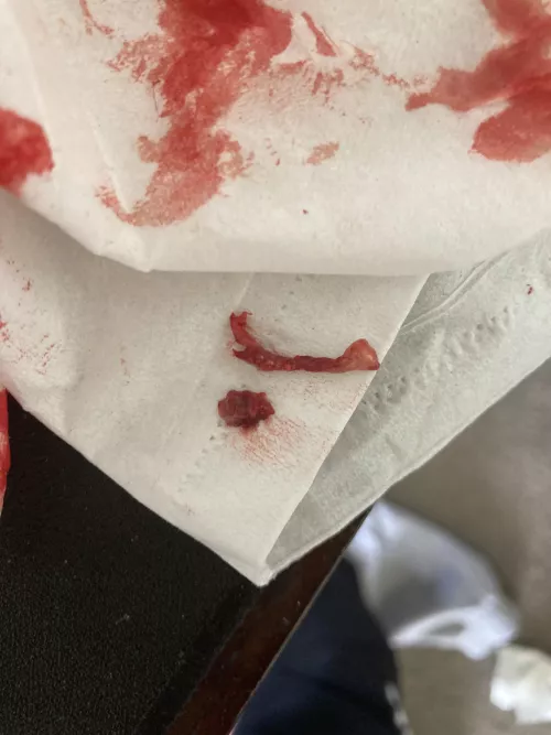 pulled a lot of this stuff from my armpit lol. (Picture is not all of it) wtf is this