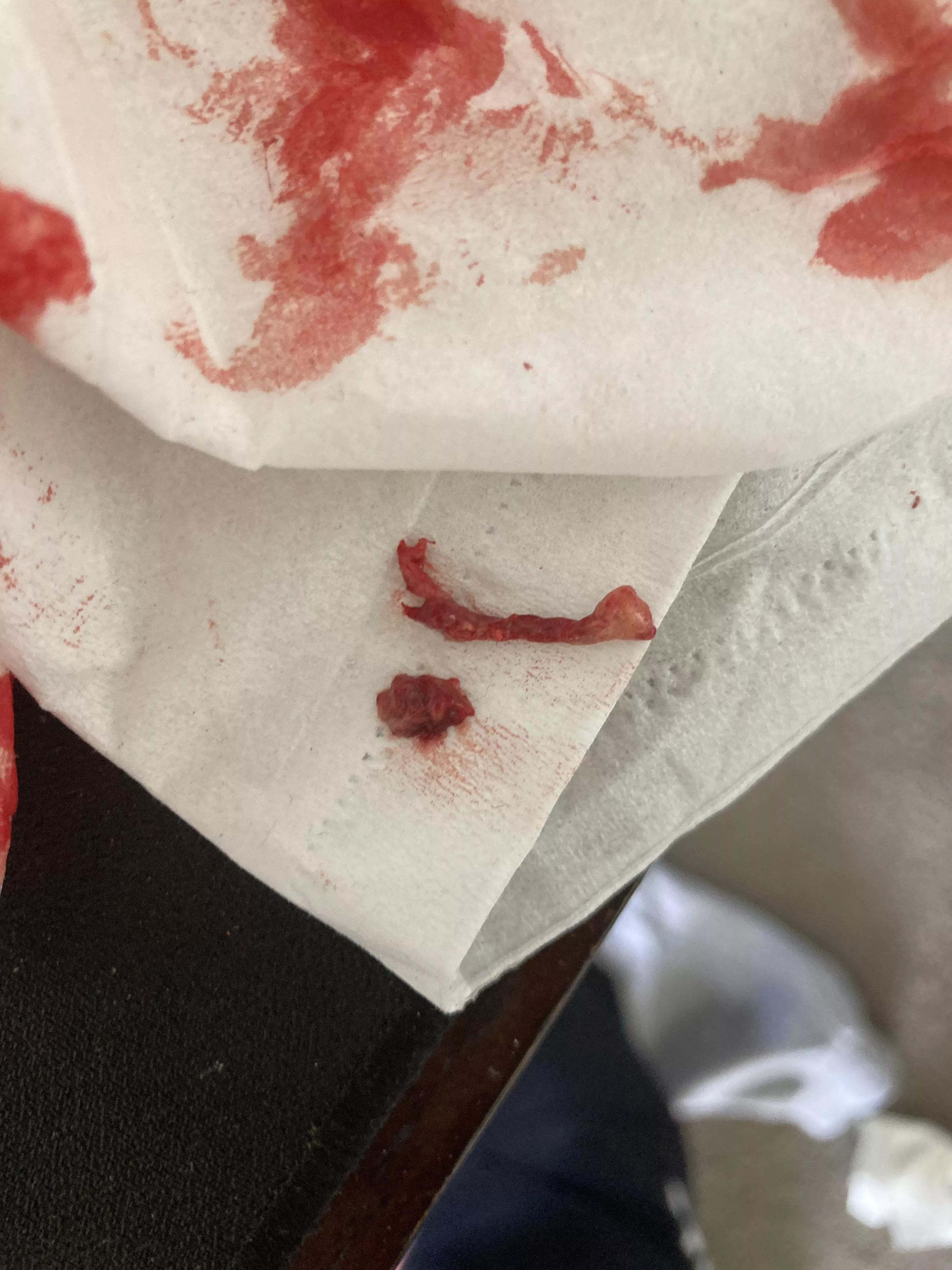 pulled a lot of this stuff from my armpit lol. (Picture is not all of it) wtf is this