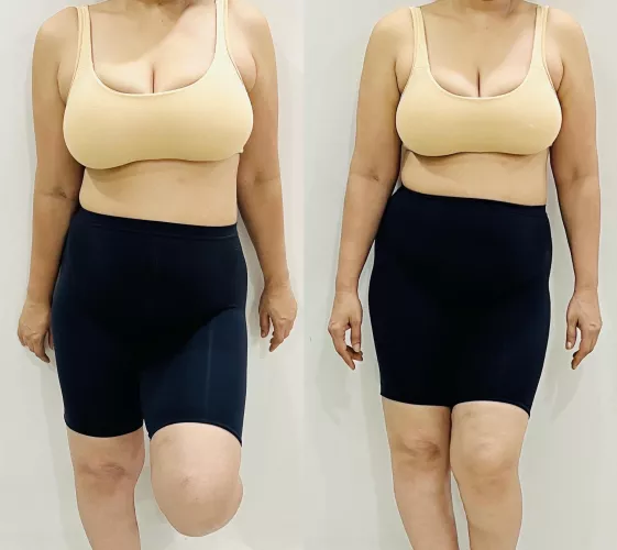 After my exercises. I can keep pace with the younger guys, make full use of their stamina and squeeze out all their juice😉 47F OC Repost (F)