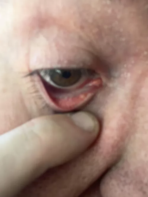 Got this little bugger today 😔