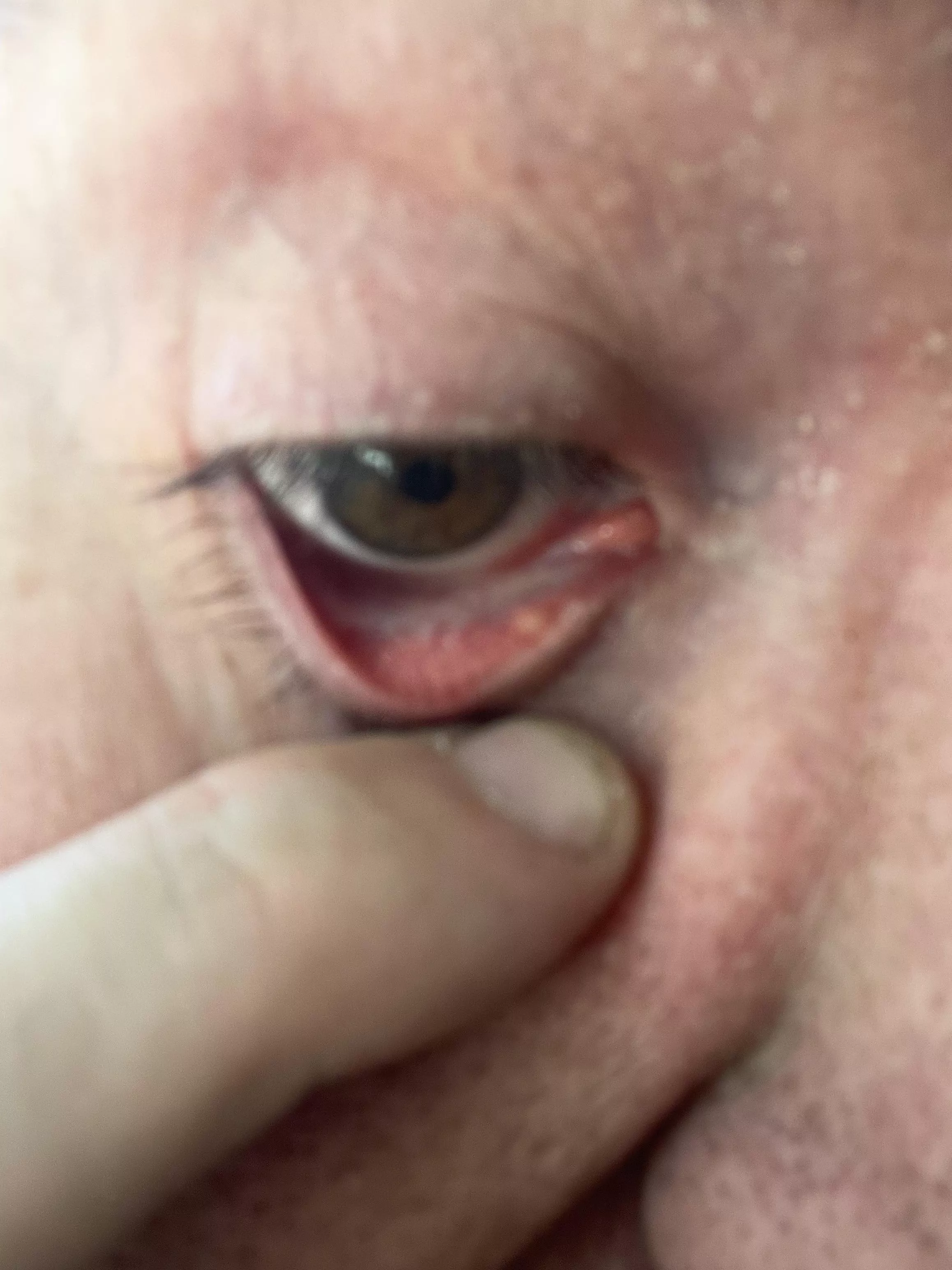 Got this little bugger today 😔