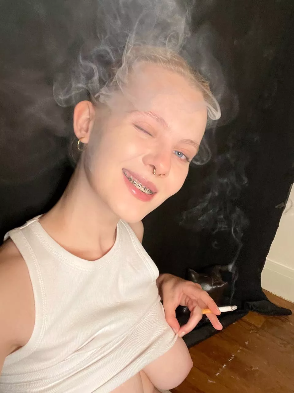 wink wink with braces