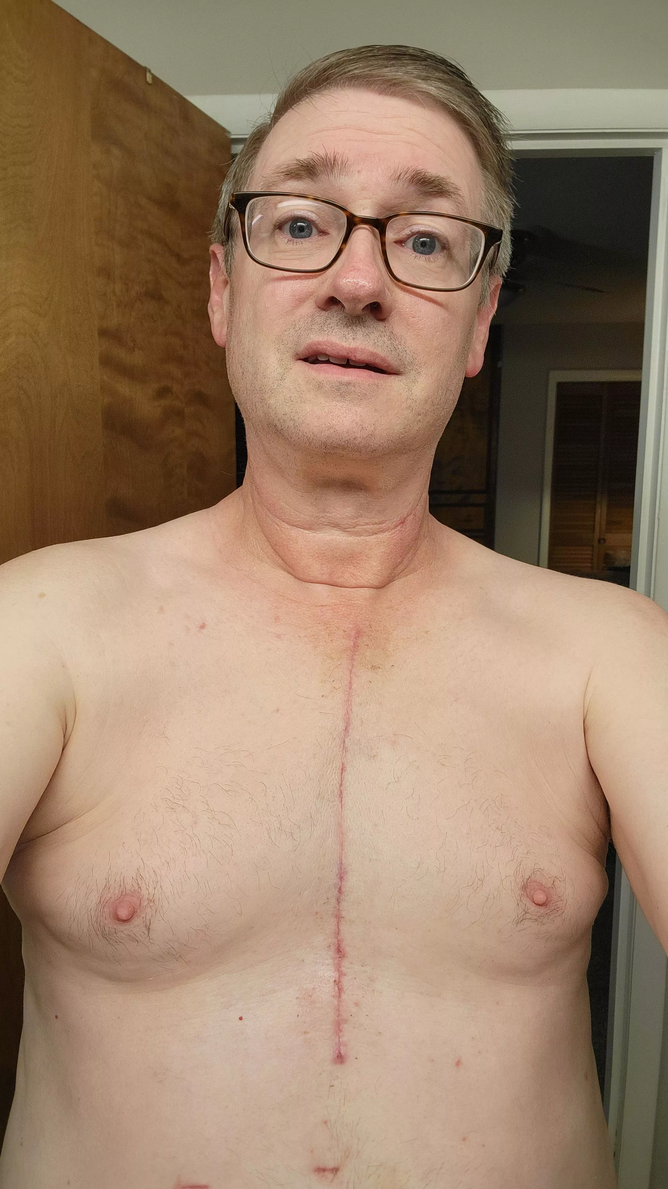 My new scar [56; 178#; 5'11