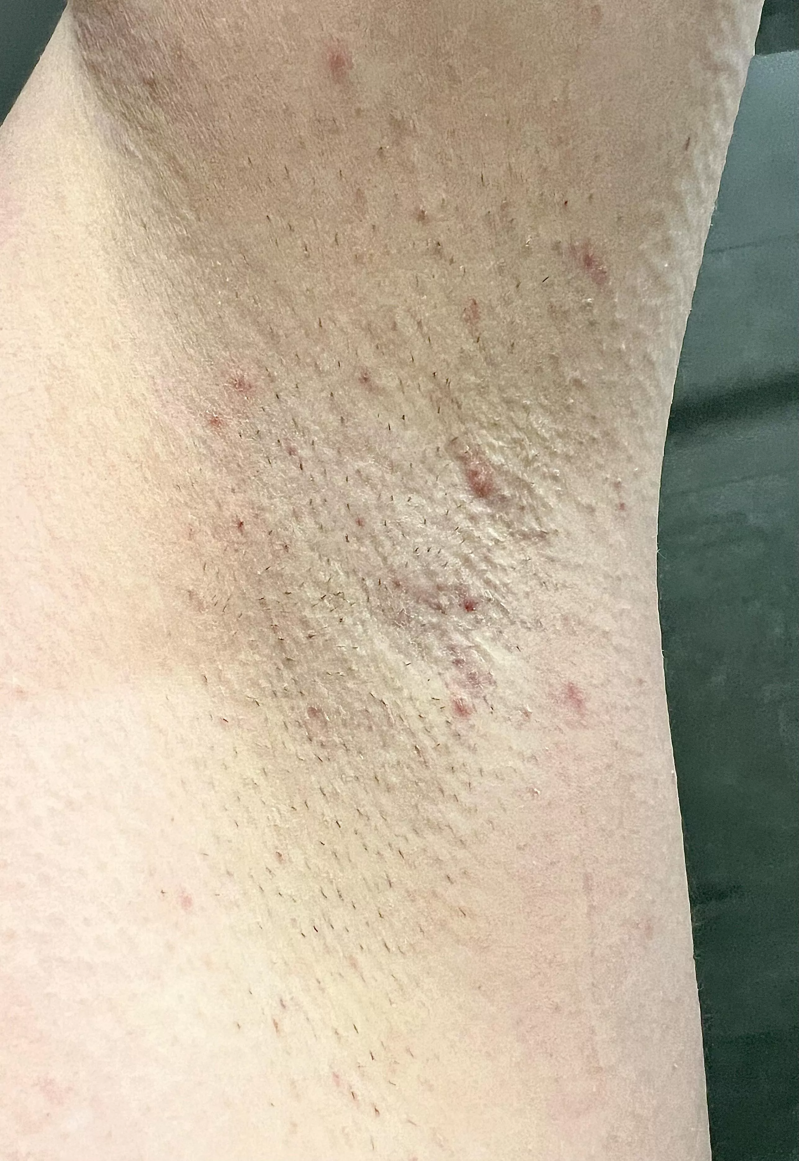 A little fresh stubble 🥰