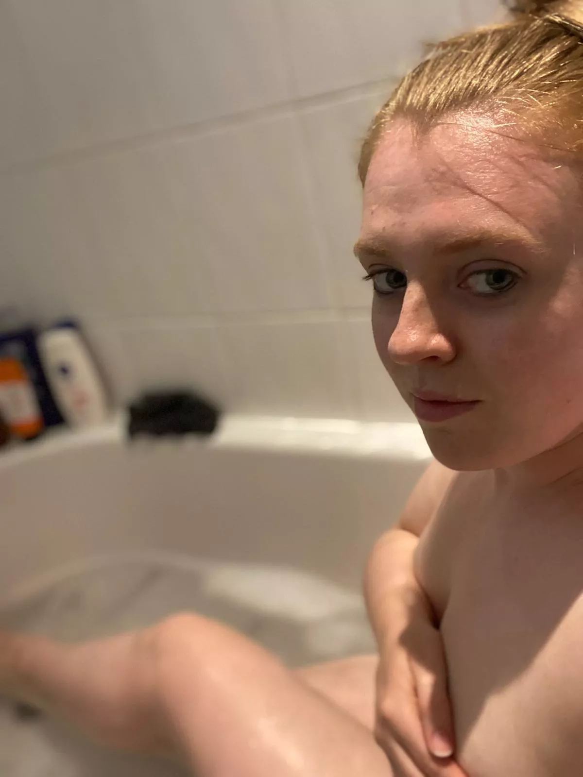 F(32) 5’5 140lbs 💛 Never thought I’d be able to post a photo like this of myself online, but here I am 😳