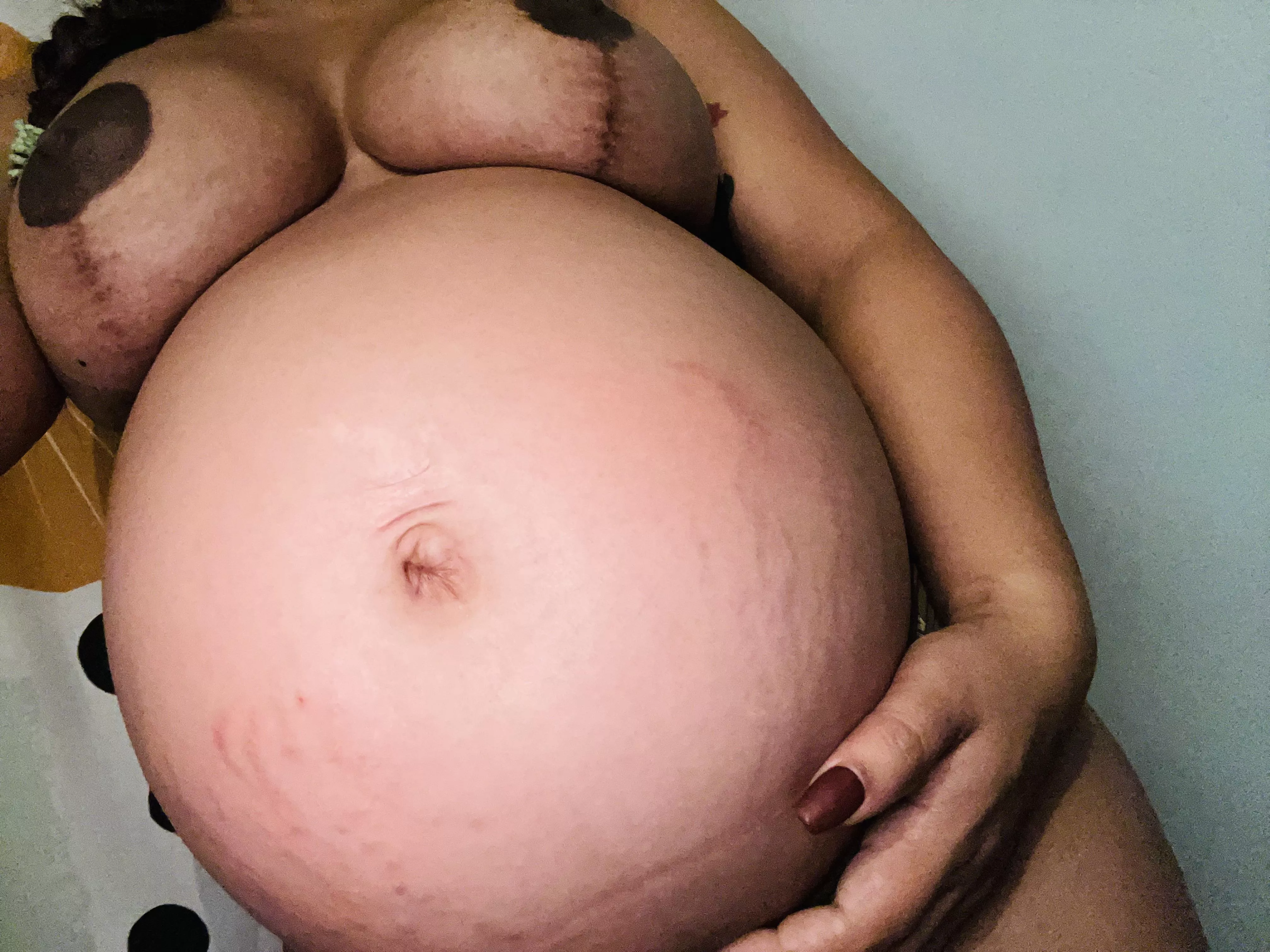 Getting the ugly stretch marks ): 🥺