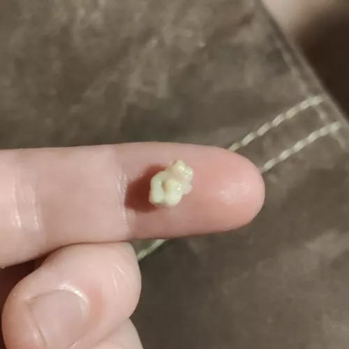 tonsil stone? (I'm not sure if it is one) that came out of my mouth.