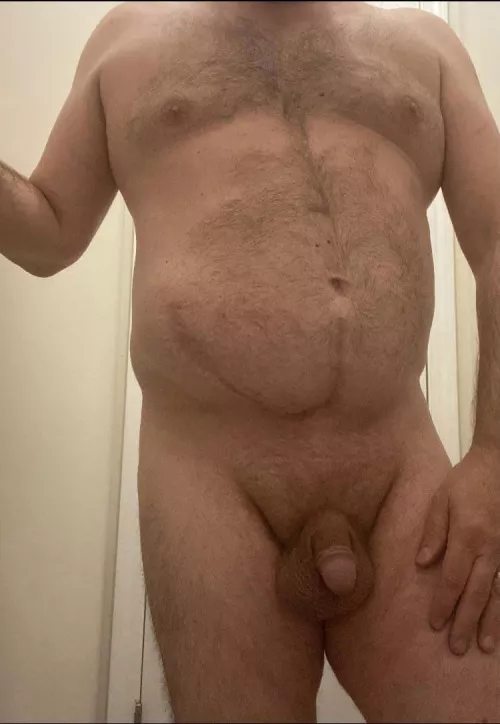 (52) What’s life without a few scars?