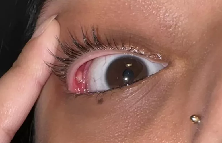 Forbidden Pop: my first internal stye worst thing ever