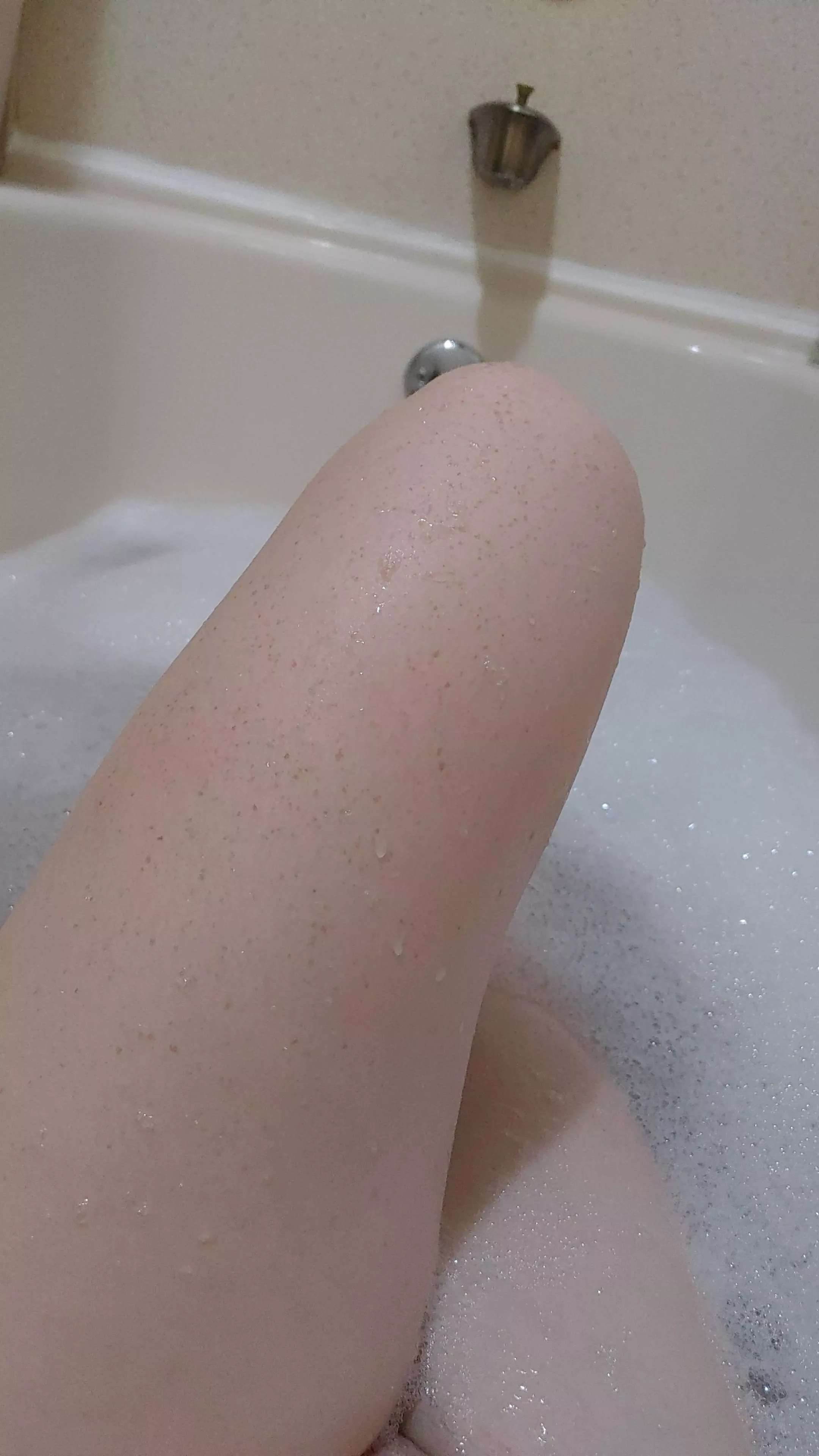 Freckles and bubbles.