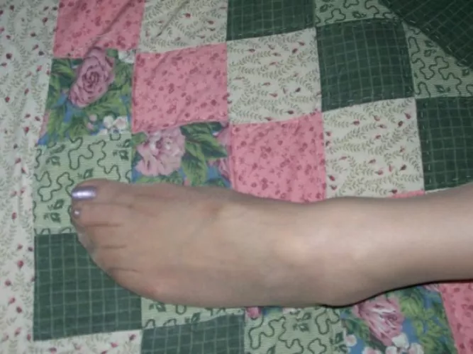 Just one lonely nylon foot