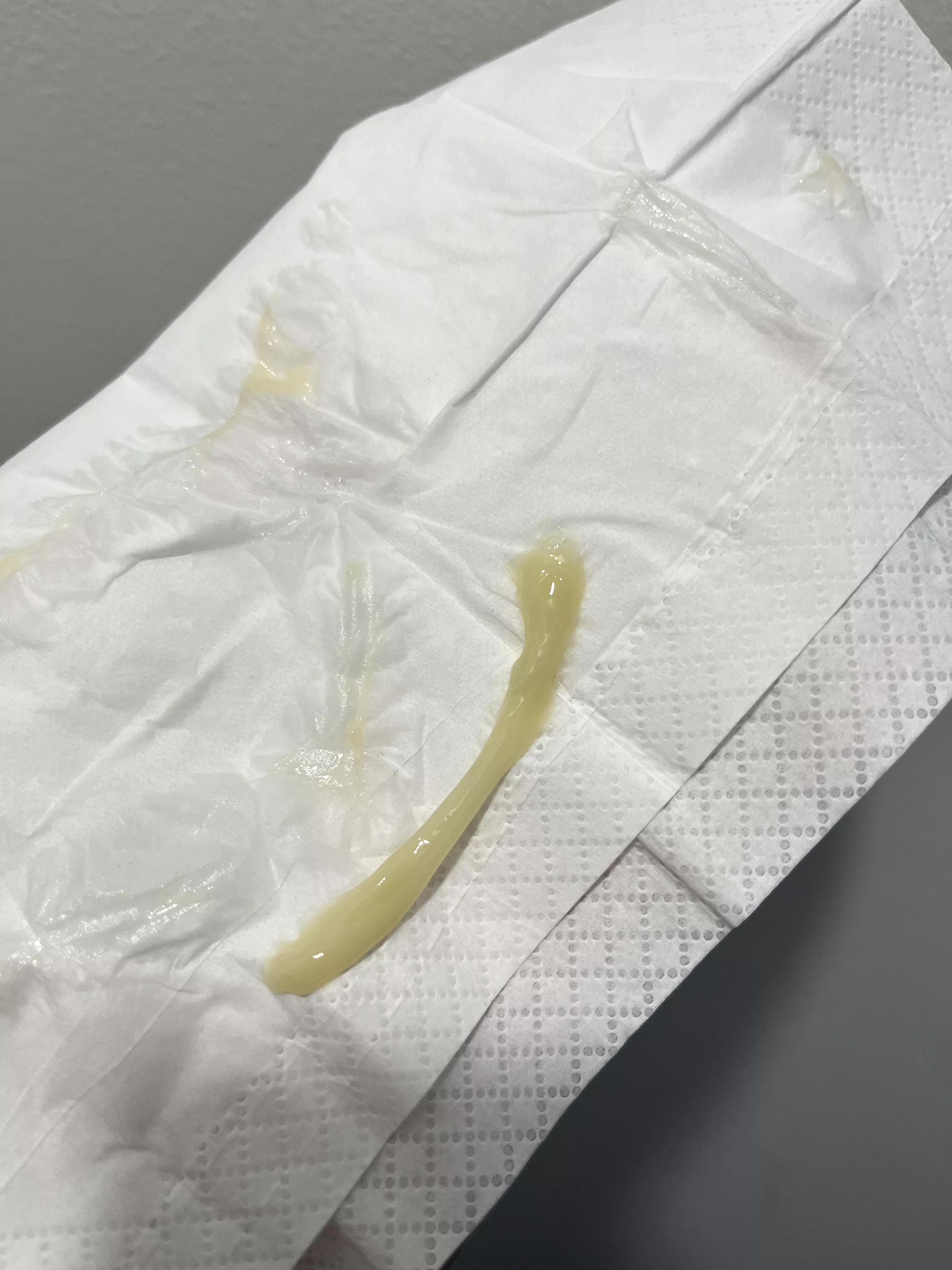 Pulled out of my nose. I can smell colours now.