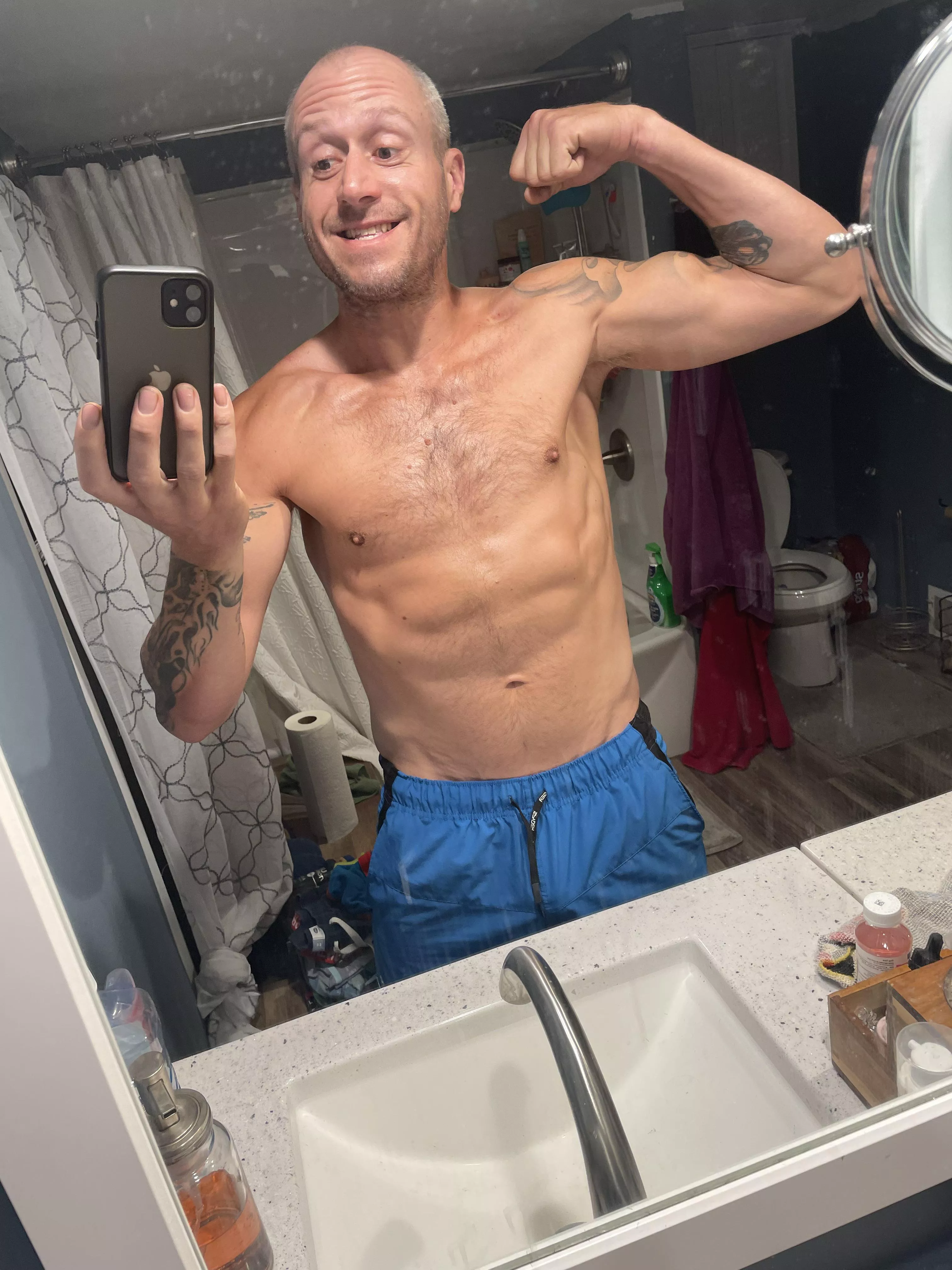 M 40 right before shoulder surgery!