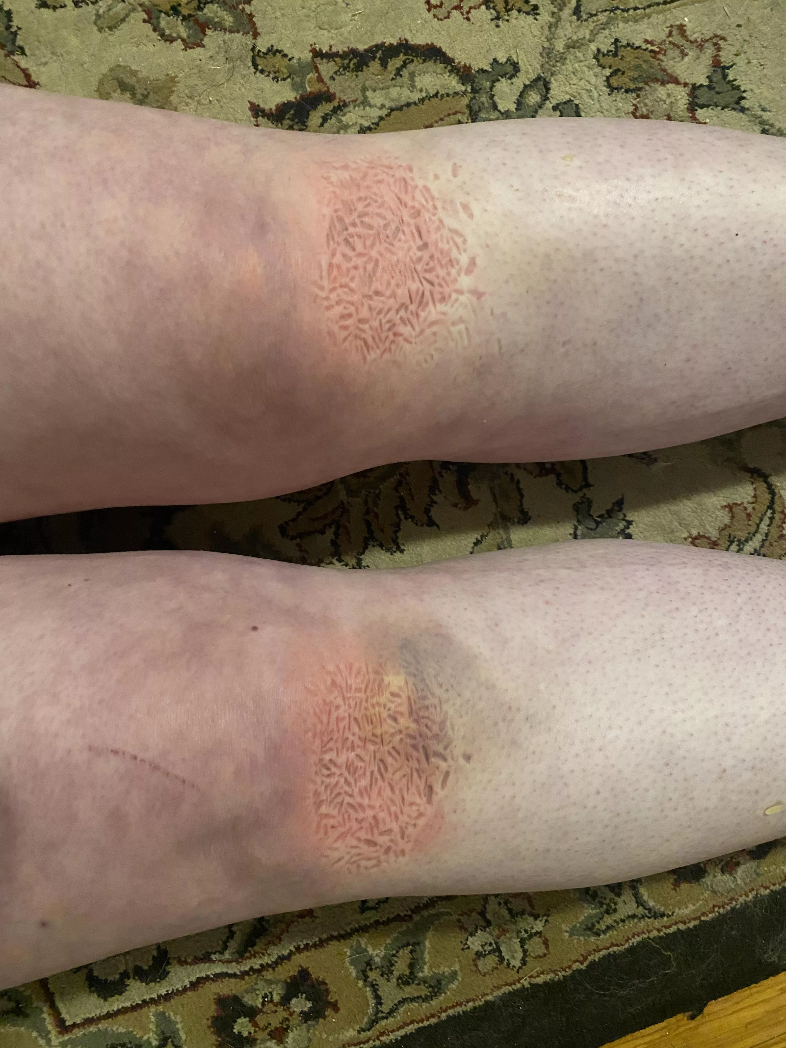 My punishment: kneel on rice for 15 minutes.