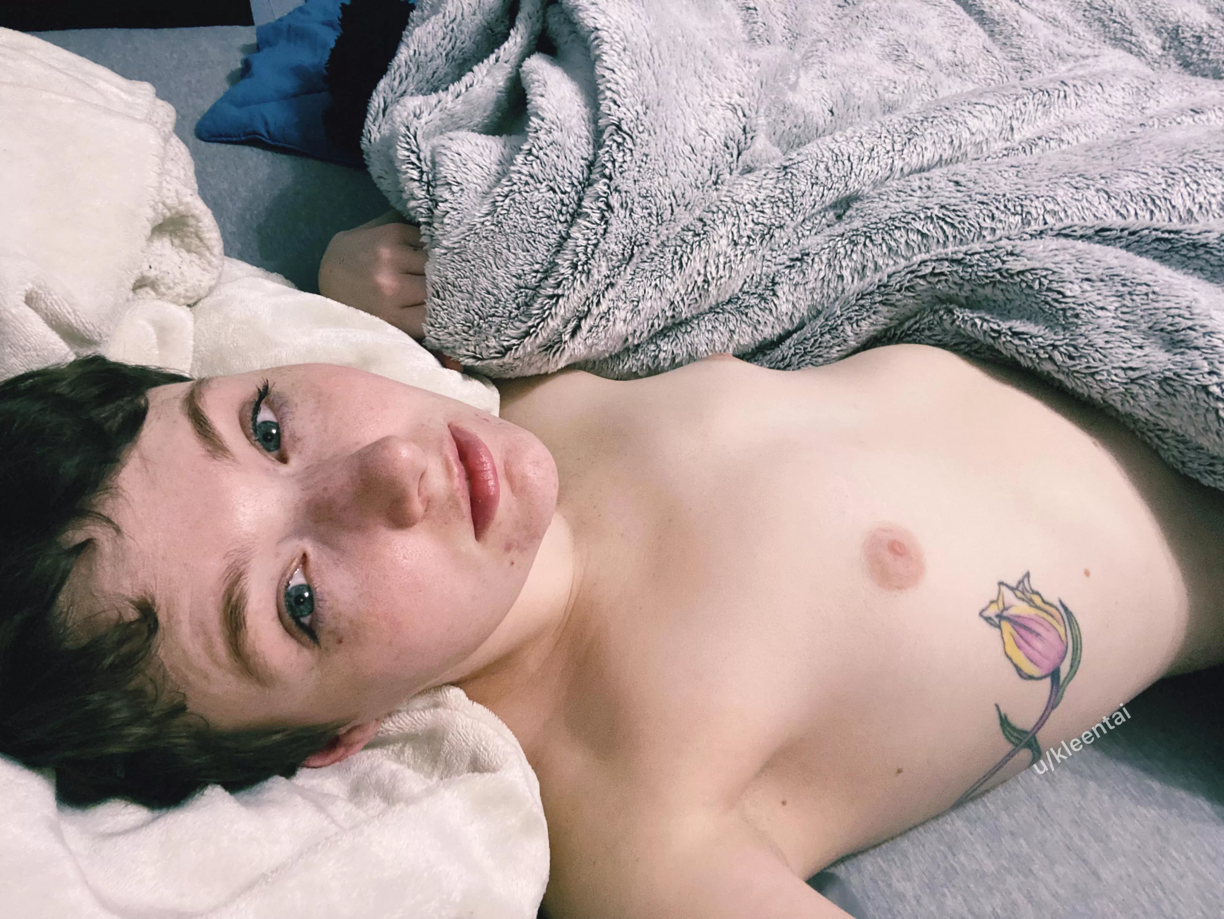 Freckly good morning