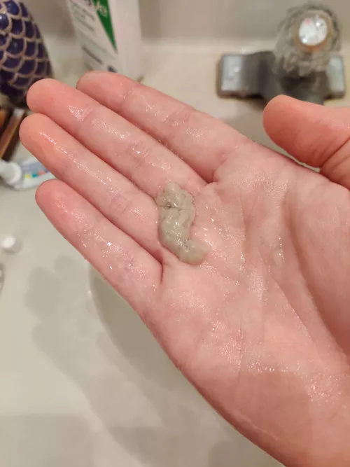 Friends been sore throat all week after coming back from Brazil. He spat this out today.