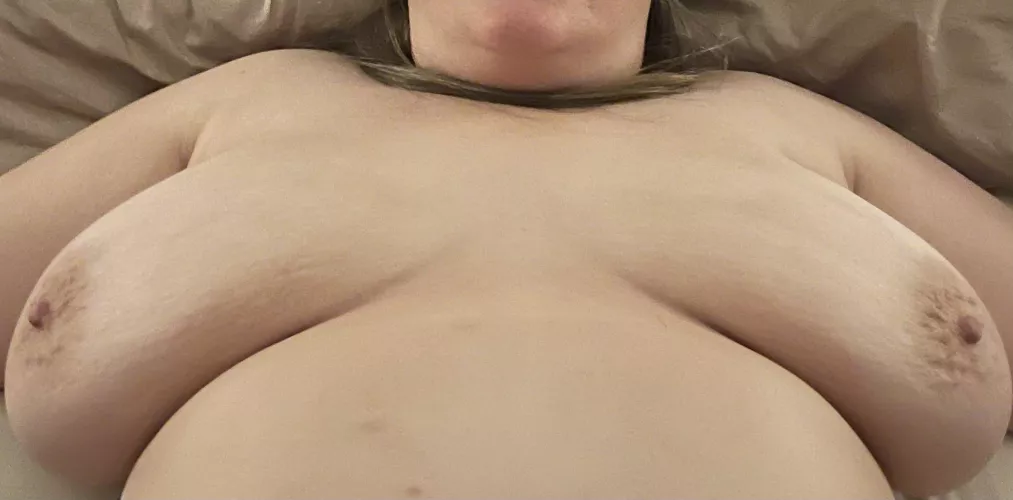 Please rate my 49 year old boobs