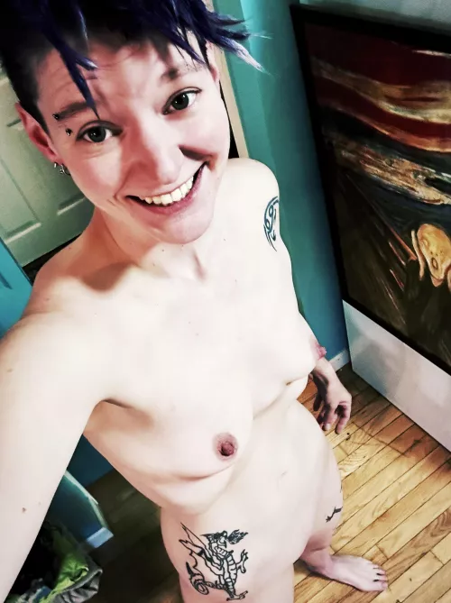 Always trying to accept myself (Marfan syndrome)