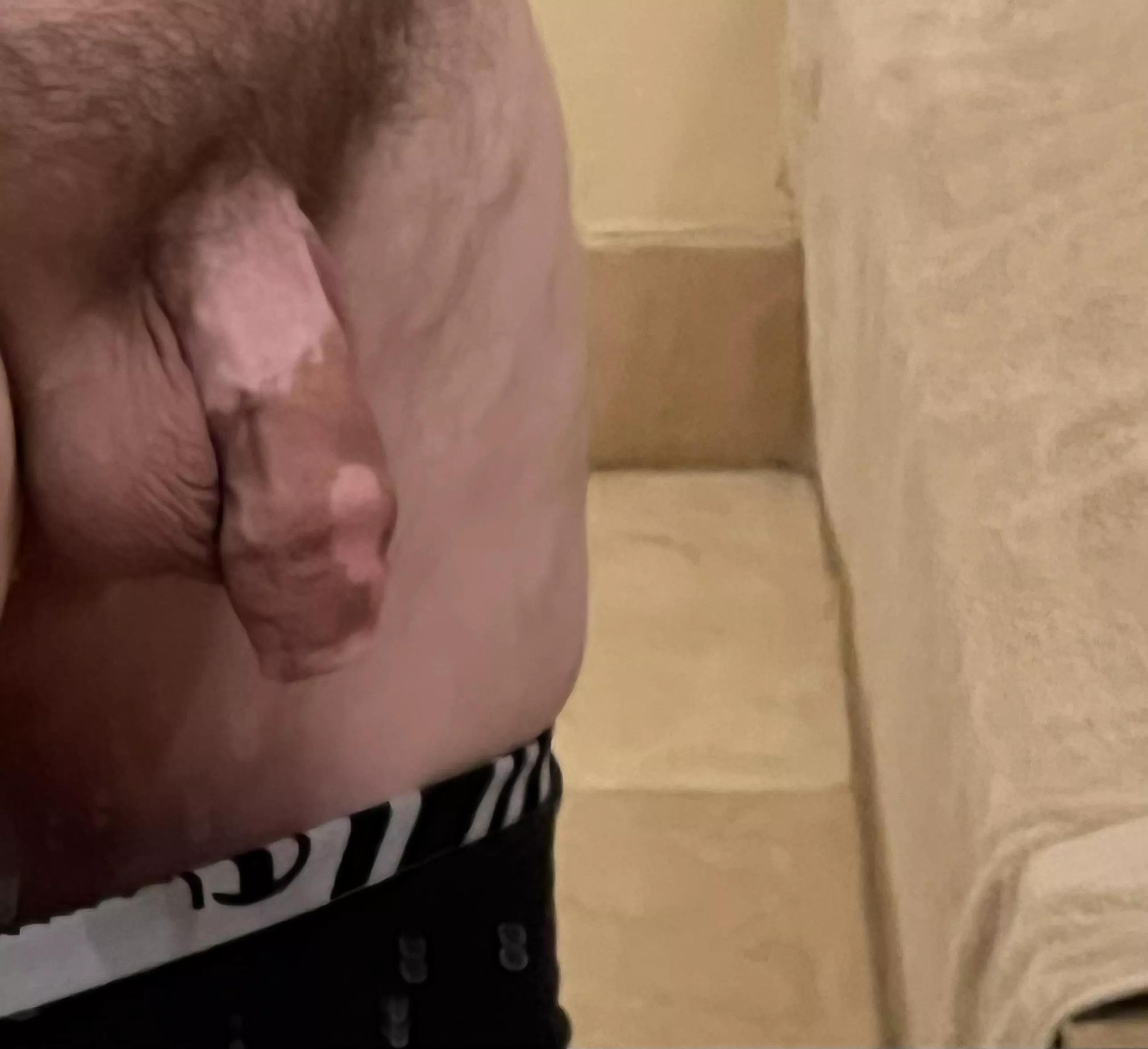 I have vitiligo. It’s harmless.