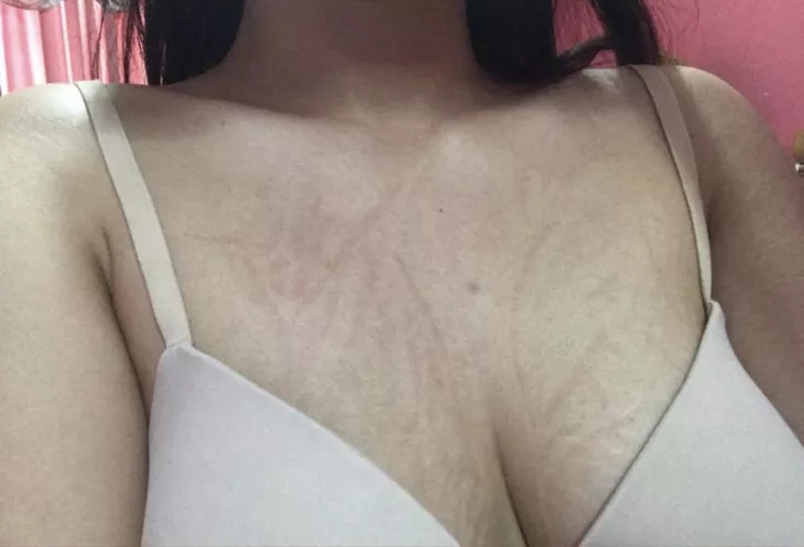 Slept with no shirt on