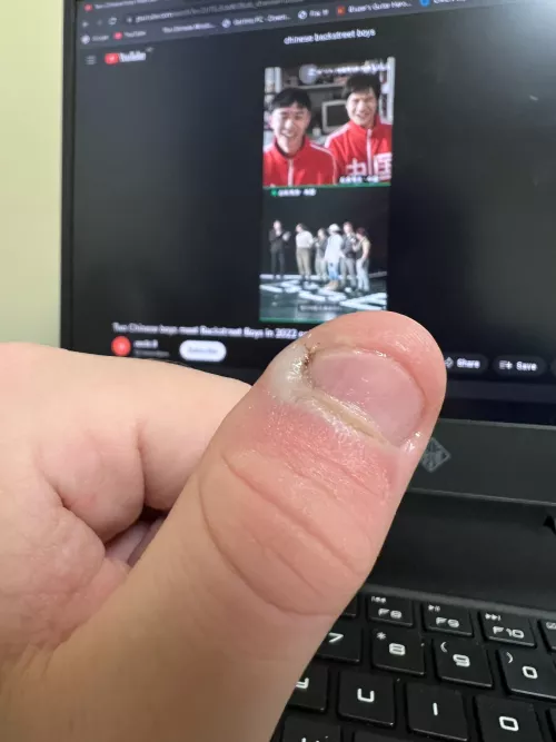 What is wrong with my thumb?!