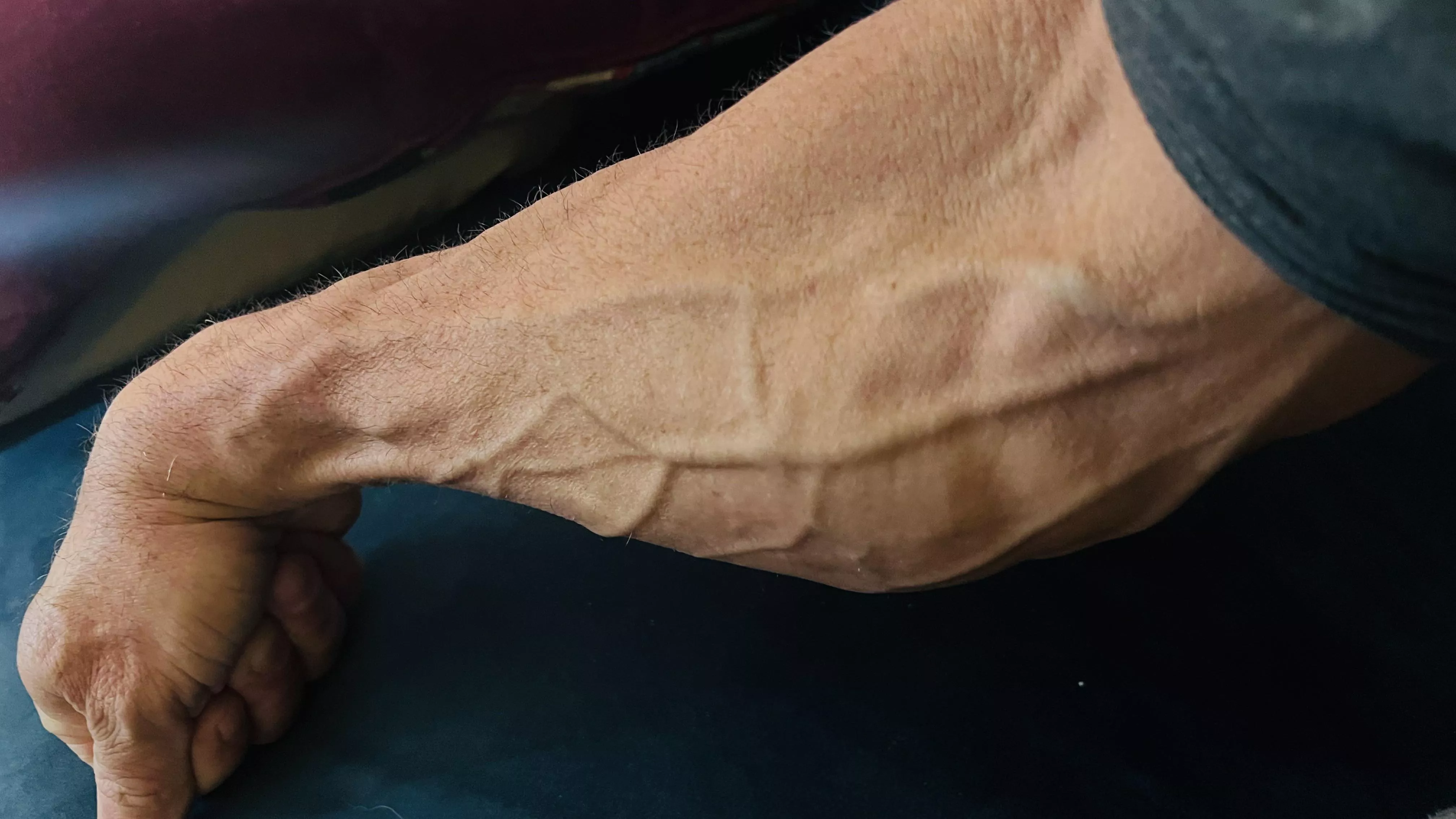 Lifetime of building fence