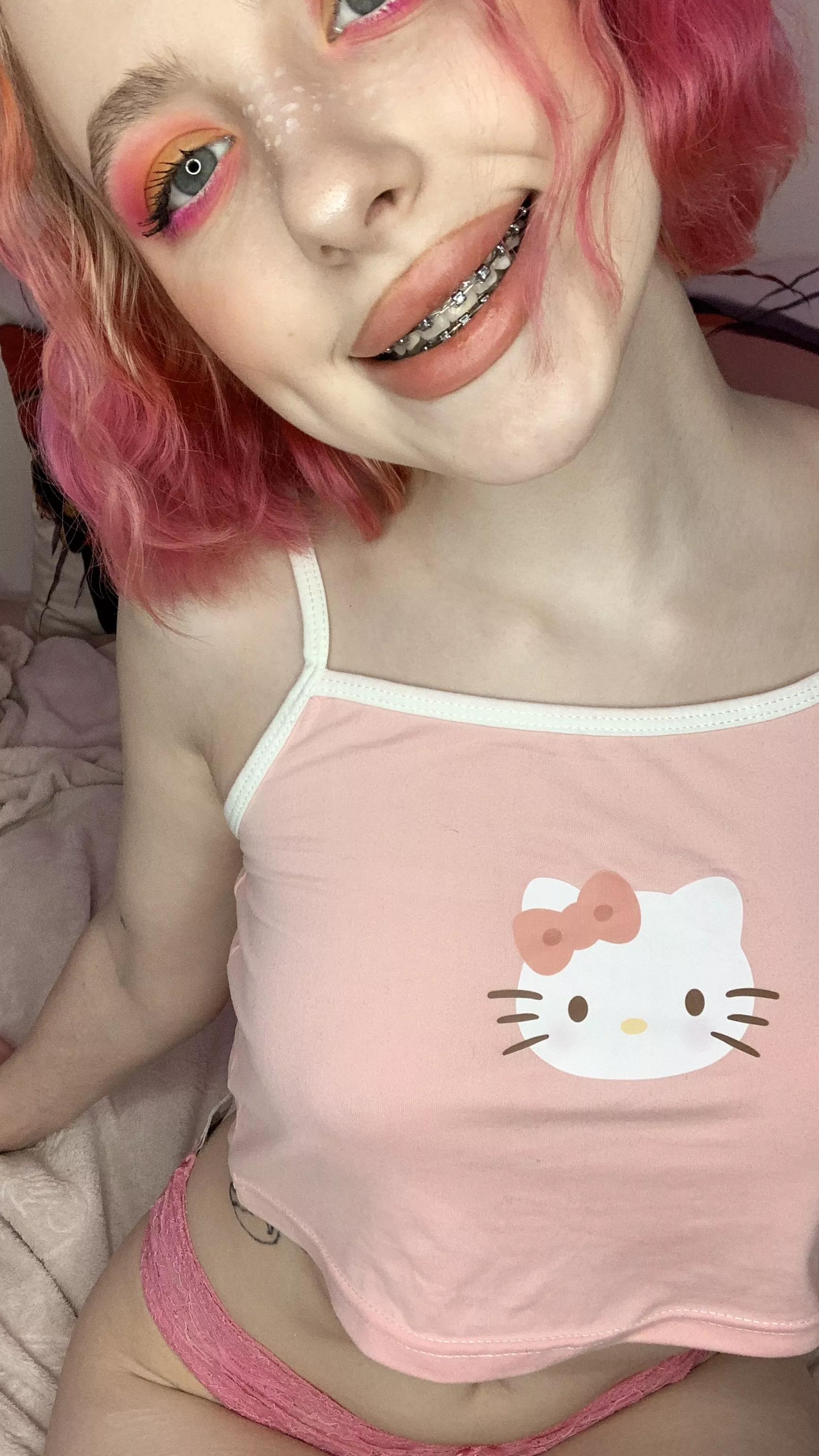 kitty with braces 😻