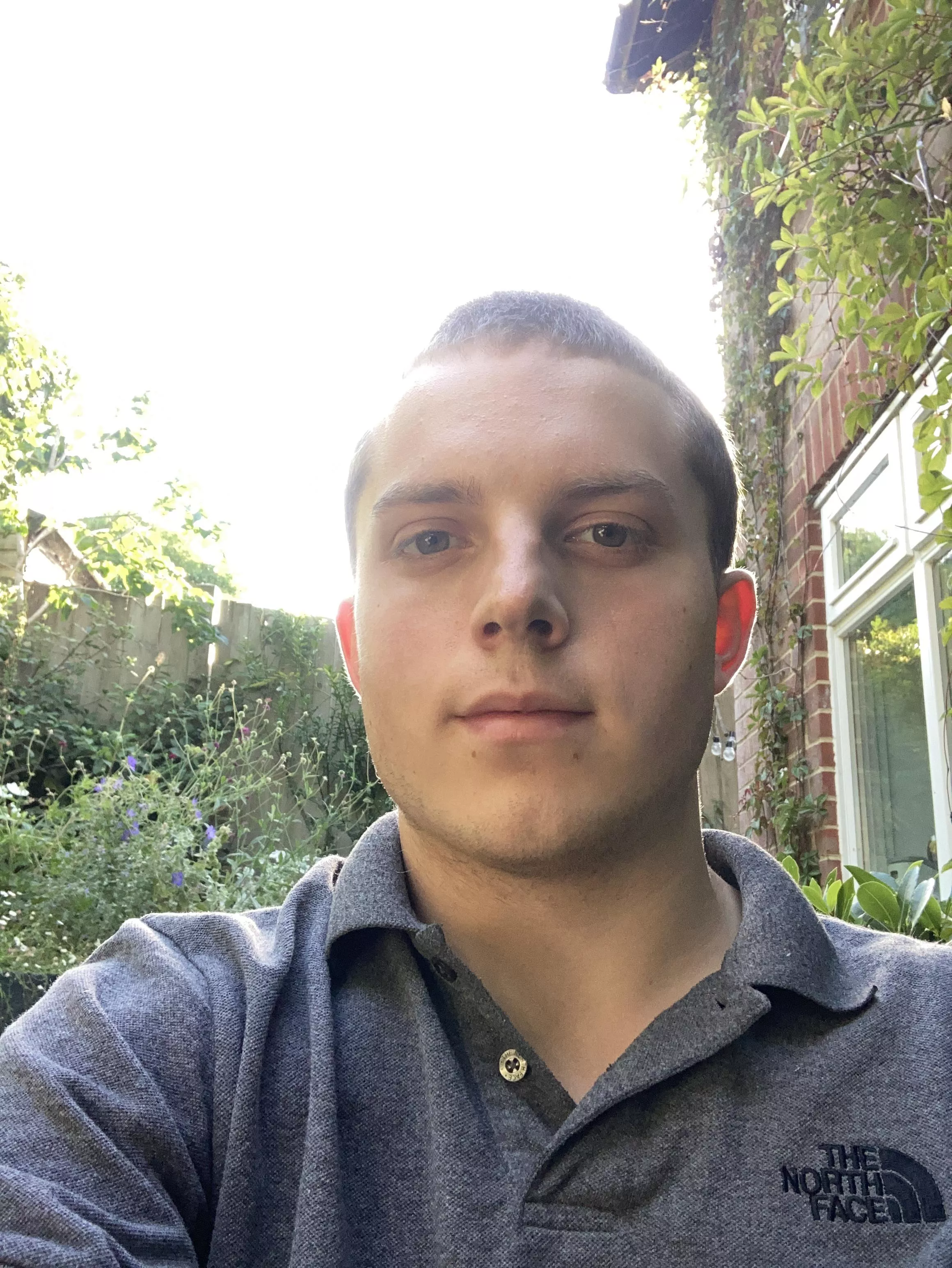 Does my cheek scar bother you?