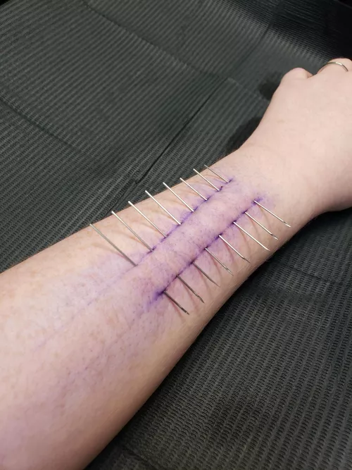 I got turned into a pin cushion for my birthday!