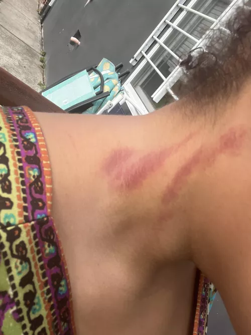 I love it when he sucks on my neck and claims me as his!