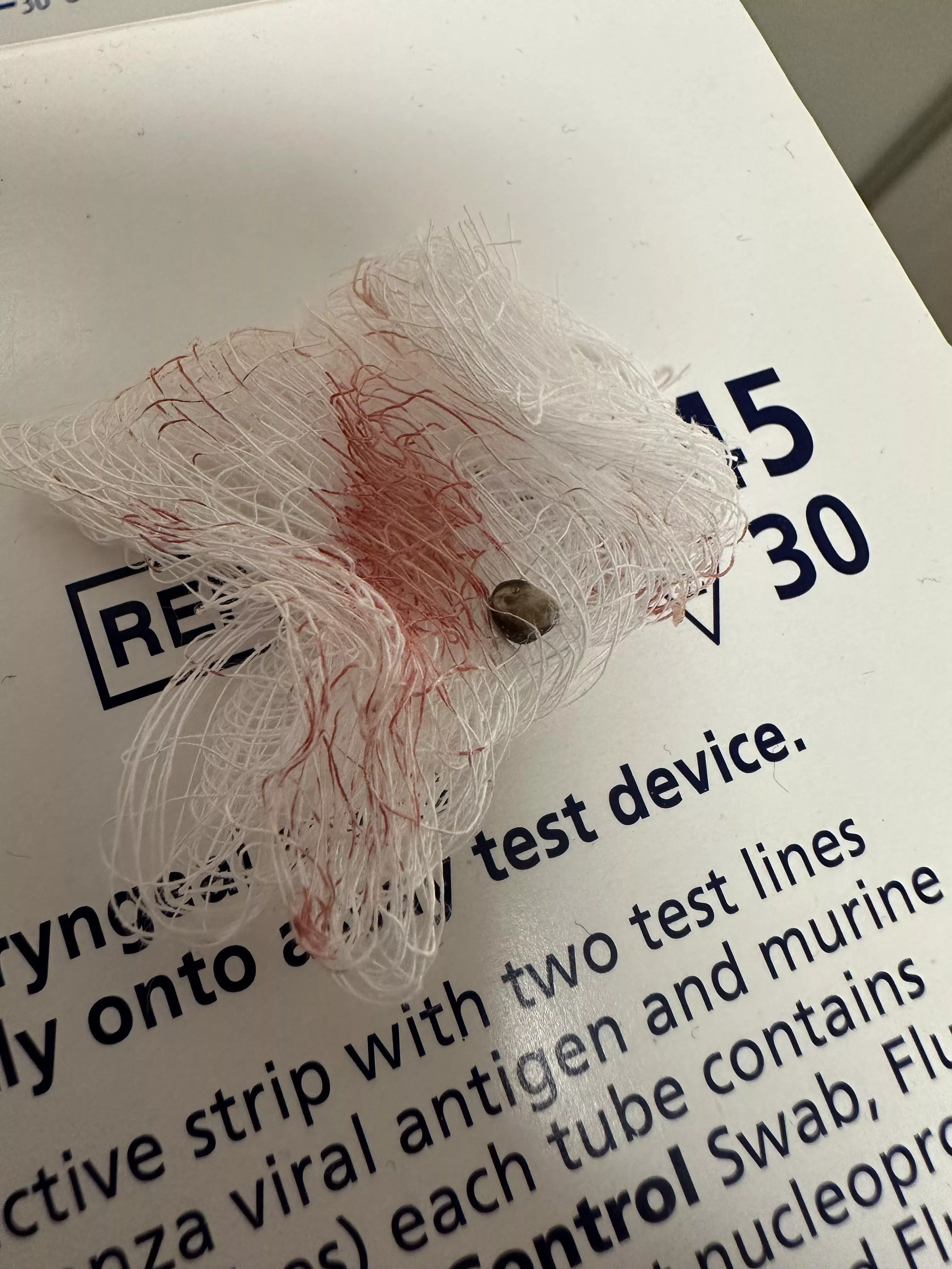 Removed this from an arm today