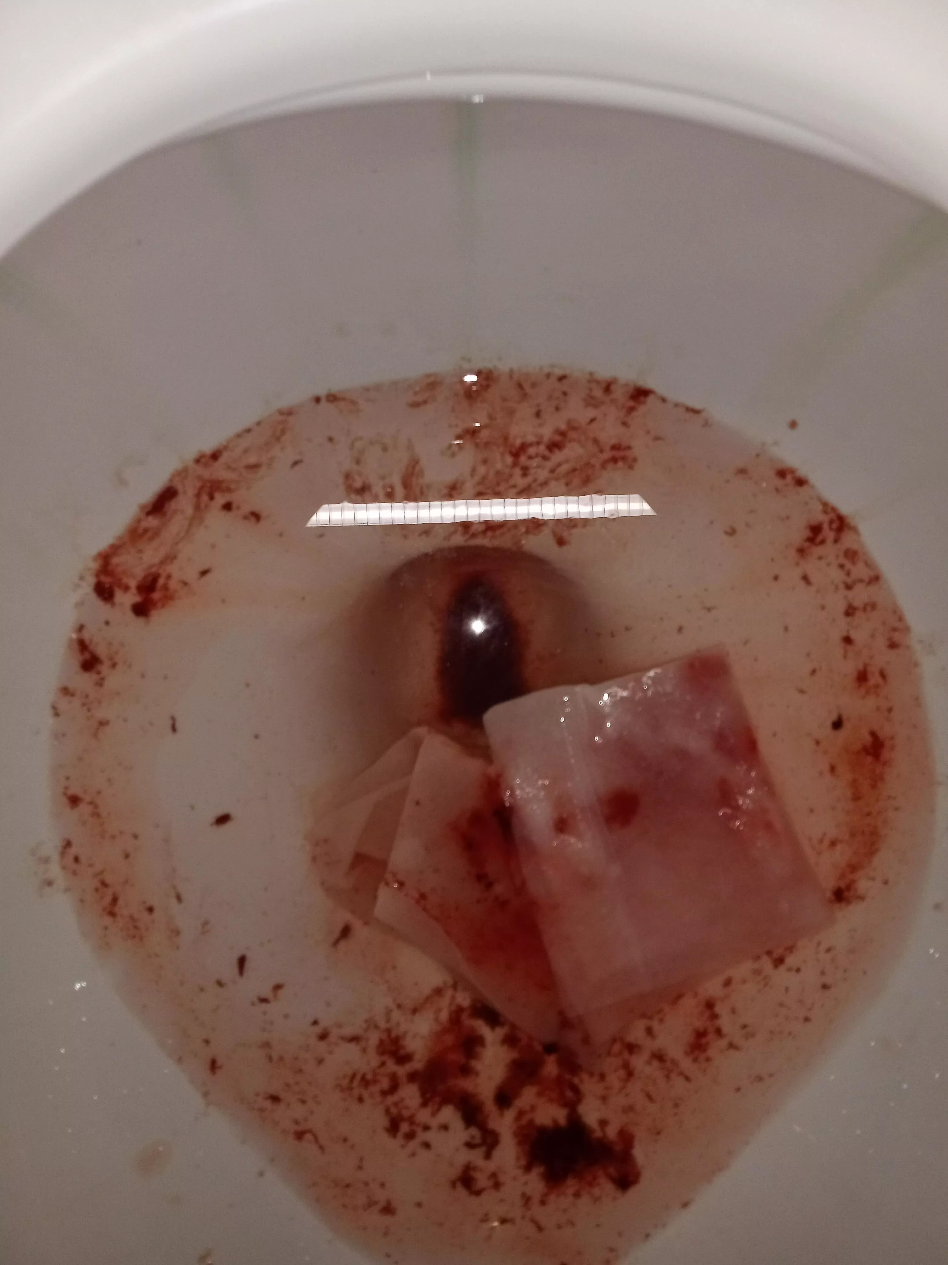 Update: Abcess burst, story in comments..including pic of the toilet immediately afterwards (bloody)
