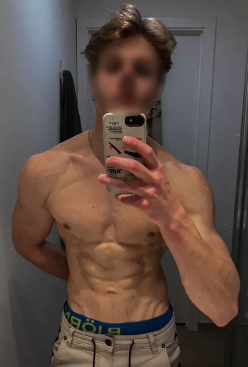 Are lower belly veins allowed?