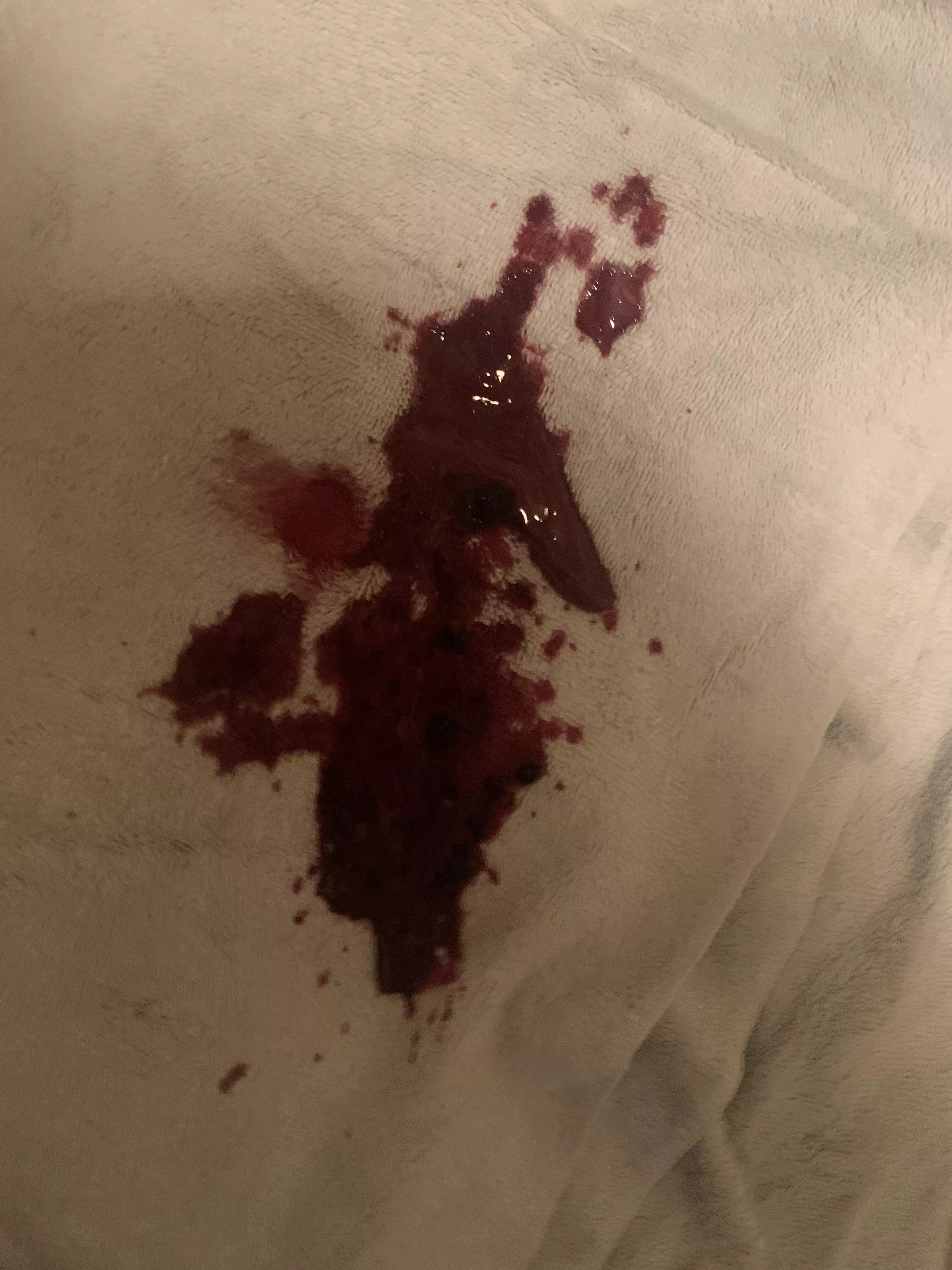 Had a boil on my waistline. Burst (semi) unexpectedly while on the toilet.