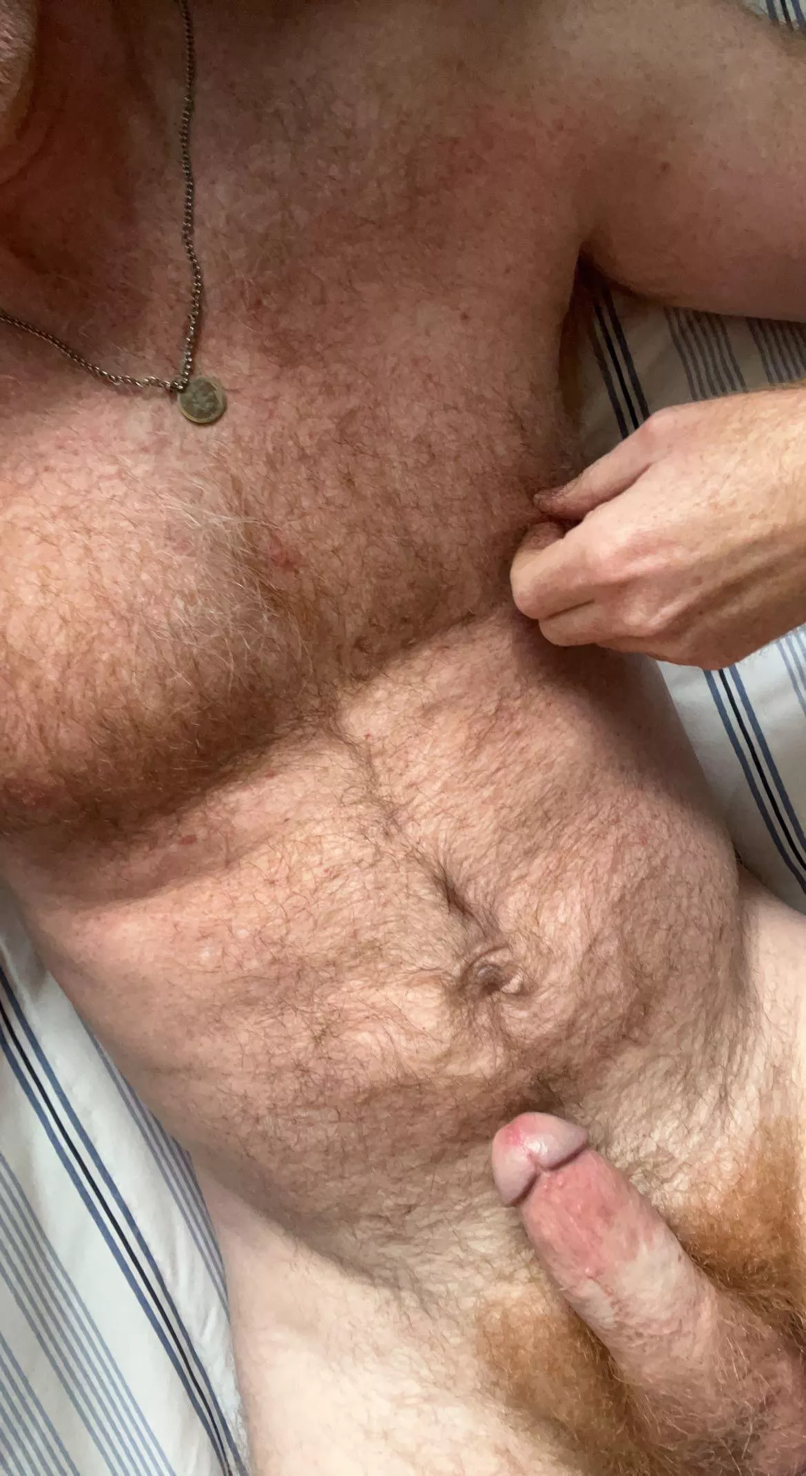 It needs some attention [44]