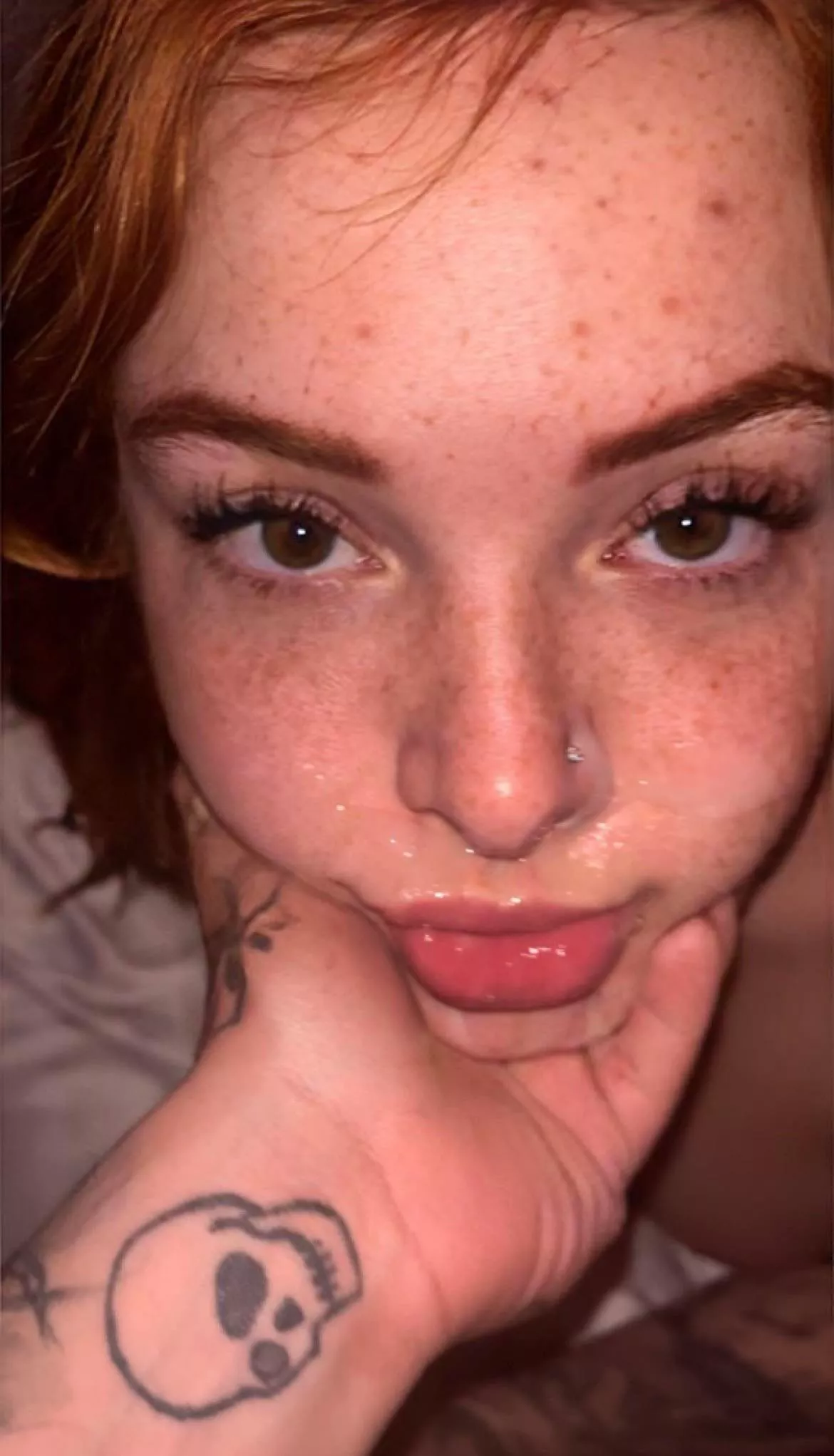 Nut on a gingers freckles