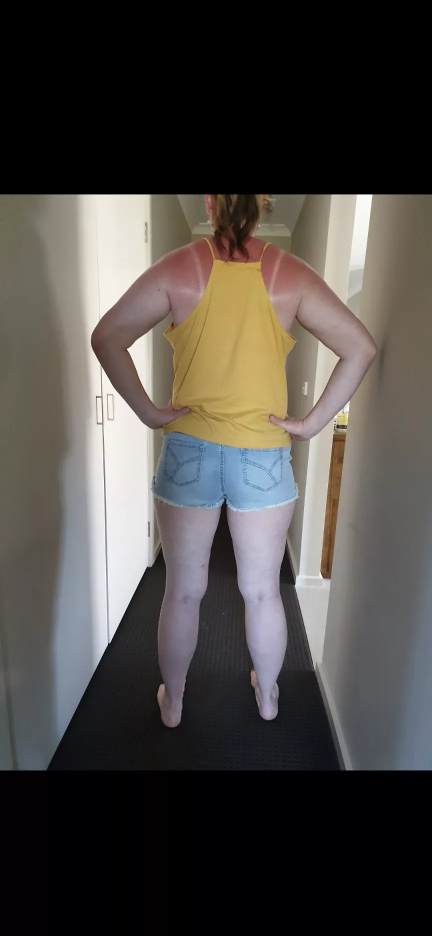 Tall wife = long legs! Ft. Sunburn lol show some love!