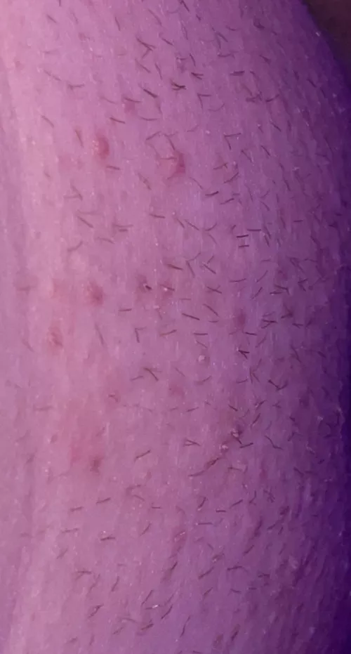 i literally don’t know what to do about razor bumps. i get ingrowns so easily too😩