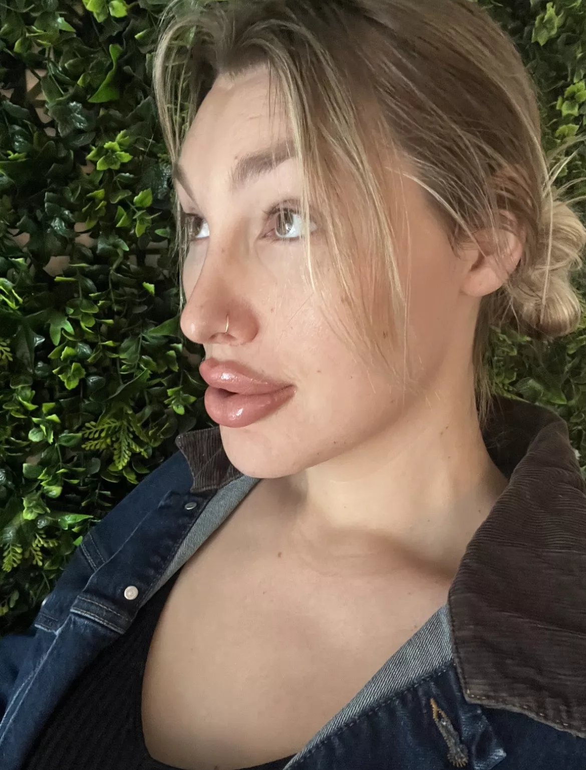 Just got my lips done. Are they boltons yet?