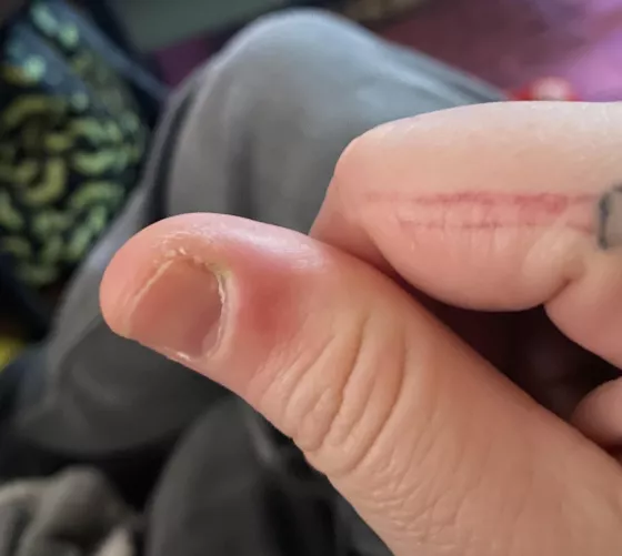 Just waiting for the right moment to pop.