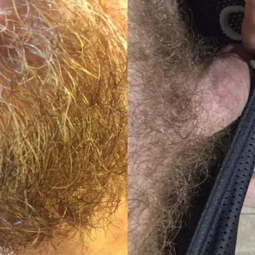 My beard hair has the same texture as my pubes.