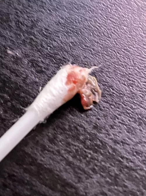 Not a pop, but the relief I get from pulling this out of my ear is divine. Had this ear infection since September.