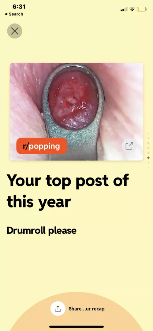 This is so funny I’m so glad this is my legacy (NSFW for blood / mild gore)