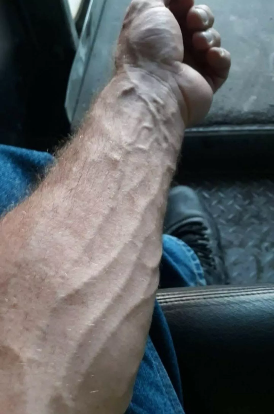 fat forearm..