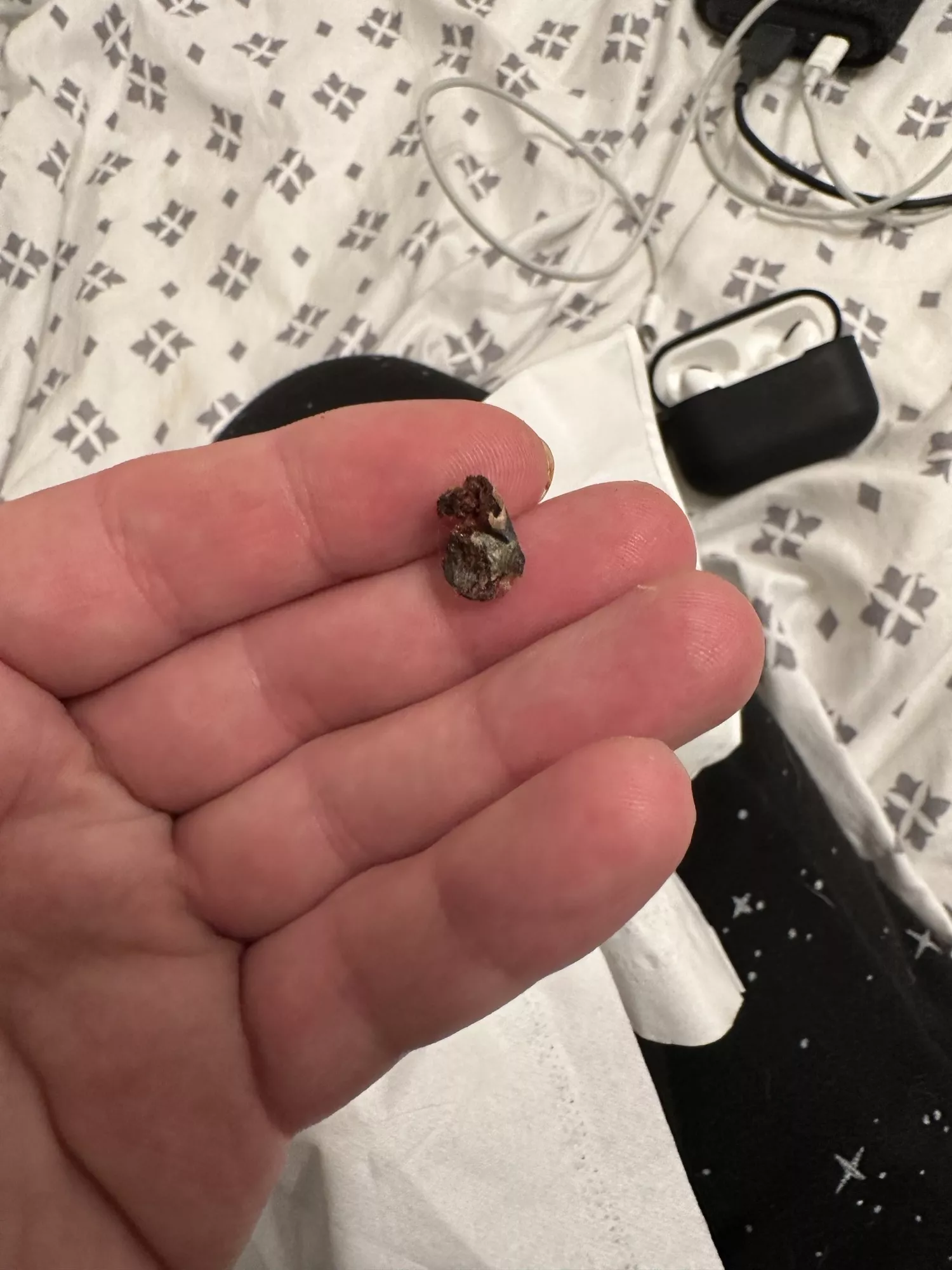 Pulled this out of my left ear after a shower. Up until now I thought I was going deaf in one ear.