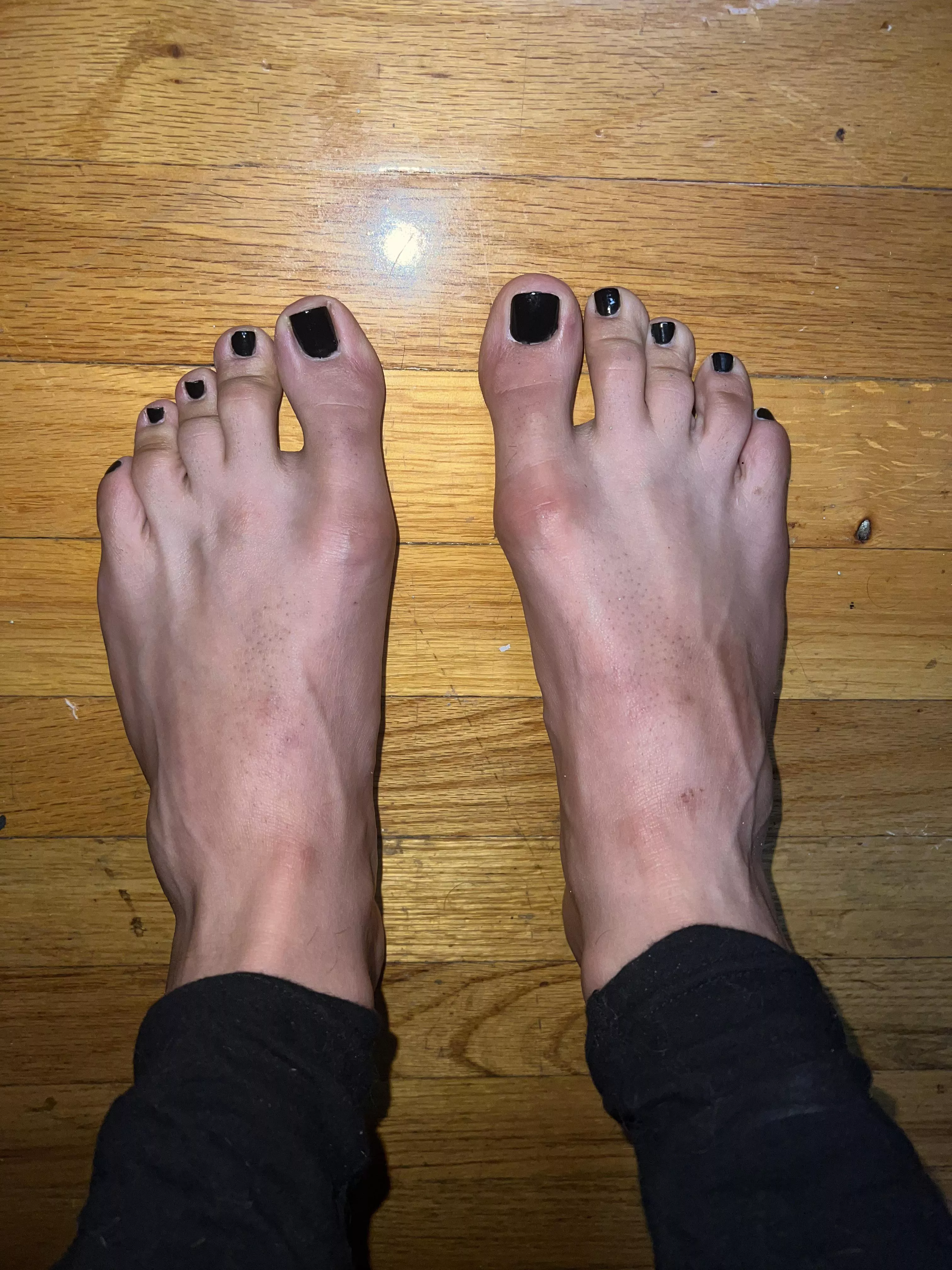 Black toes 🖤