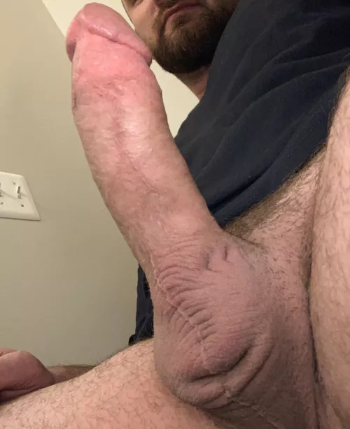 This is what you call a blue vein throbber